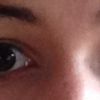 Symmetrie meiner Augenpartie bei unterschiedlichen Augenhöhlen? - 27179