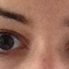 Symmetrie meiner Augenpartie bei unterschiedlichen Augenhöhlen? - 27180