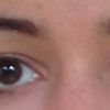 Symmetrie meiner Augenpartie bei unterschiedlichen Augenhöhlen? - 27181