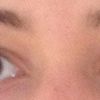 Symmetrie meiner Augenpartie bei unterschiedlichen Augenhöhlen? - 27182