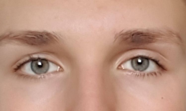 Asymmetrie an Augen ausgleichen - 27521