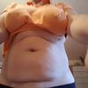 Suche Spezialisten für Fettabsaugung an Bauch und Hüfte