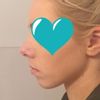 Arzt in Bayern gesucht für ästhetische und funktionelle Nasenkorrektur