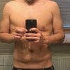 Bauchdeckenstraffung nach Abnahme von 43 kg?