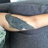 Suche Arzt/Ärztin für chirurgische Tattooentfernung