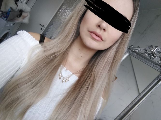 Kinn-Verschmälerung, Jawline OP