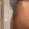 Empfehlung für Mini-Bauchdeckenstraffung in Süddeutschland