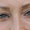 Was tun gegen Schlupflider und faltige Augenpartie?