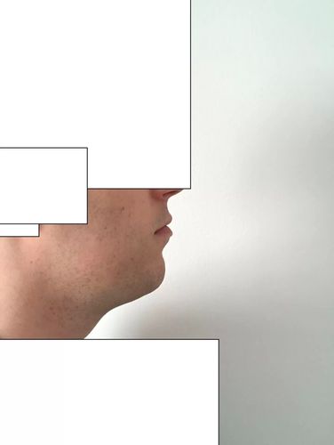 Doppelkinn trotz Untergewicht