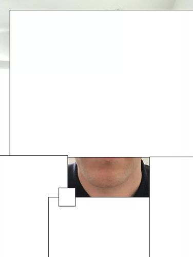 Doppelkinn trotz Untergewicht