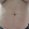 Bin ich zu dick für ein schönes Ergebnis? 