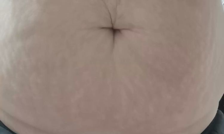 Bin ich zu dick für ein schönes Ergebnis?  - 28993