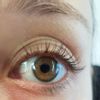 Hilfe bei dauerhaft müden Augen/ Welche Behandlung ratsam? - 29016