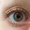 Hilfe bei dauerhaft müden Augen/ Welche Behandlung ratsam? - 29018