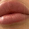 Suche Arzt in der Schweiz für Lippenvergrößerung - 29055