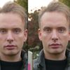 Falten/Schatten unter den Augen