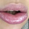 Allergische Reaktion nach Lippen aufspritzen? - 29889