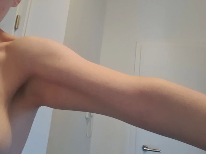 BodyTite für Winkearme