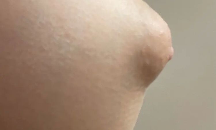 Puffy Nippels + Schlupfwarzen - 30211