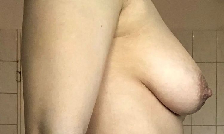 Bruststraffung und Implantate - 30337