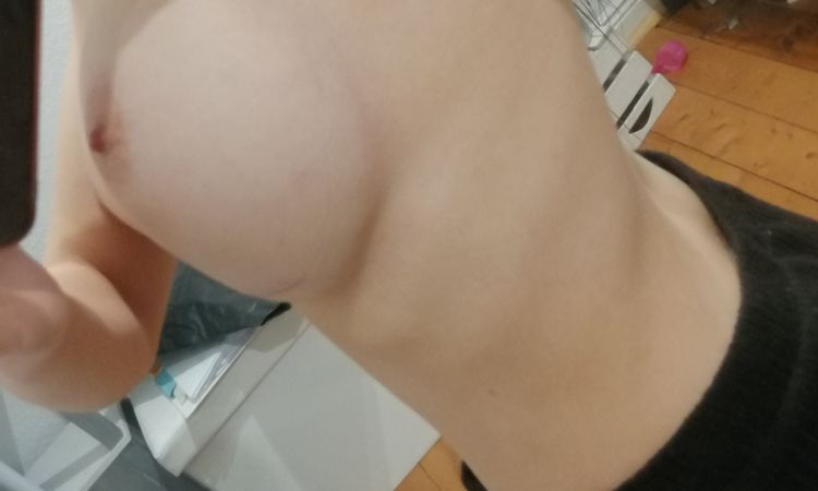 Bottoming out direkt nach der Op - selbe Implantat bei Korrektur verwenden? - 44951