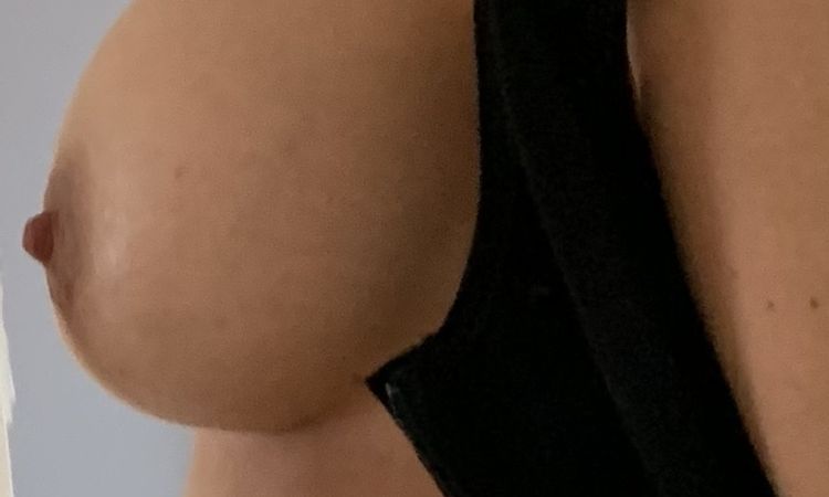 Habe ich eine Waterfall Deformity? - 48521