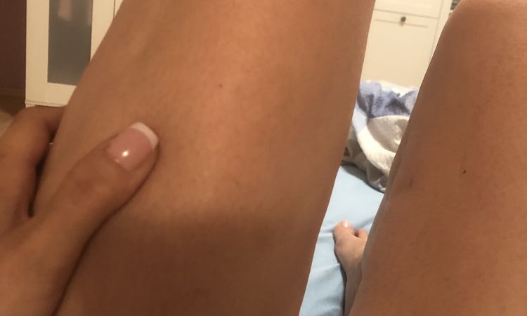 Bodytite an den Beinen - 49593