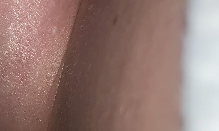 Korrektur nach Bottoming out gelungen? - 49982