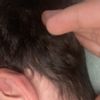 Anpassung der Helix des linken Ohrs