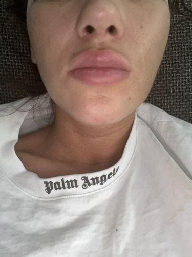 Welche ist die beste Methode um mein Gesicht zu verschmälern?