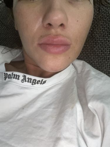 Welche ist die beste Methode um mein Gesicht zu verschmälern?