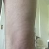 Was hilft am besten gegen schlaffe Haut an Knie?