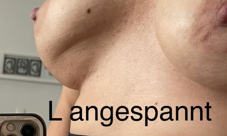 1 Jahr nach Brustvergrösserung: Brüste weit auseinander - 52848