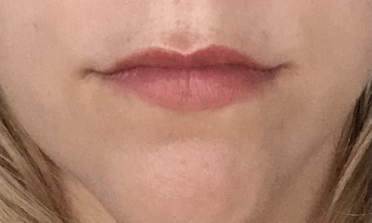 Lippenmodellierung möglich? - 54800