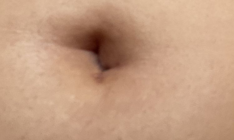 Bauchnabel - Endergebnis? - 56863