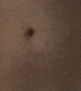 Bauchnabel - Endergebnis? - 56864
