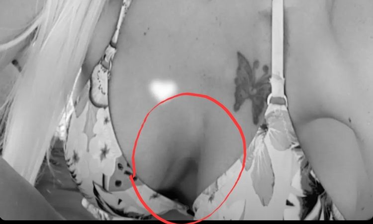 Lässt sich diese Brust korrigieren? - 61515