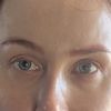 Augenbrauenlifting für unsymmetrische Brauen?