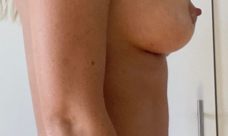 Bitte um Zweitmeinung nach Brustvergrößerung und -straffung - 64868