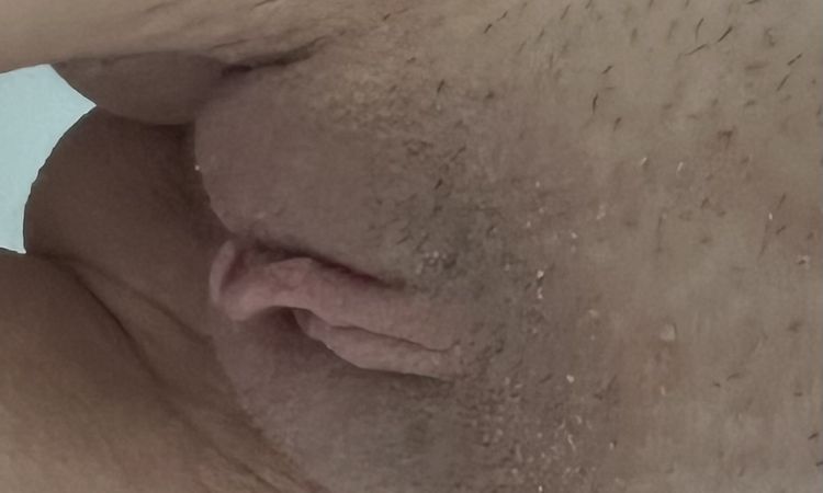 Schamlippen labien Korrektur  Asymmetrie nicht schön geworden - 67303