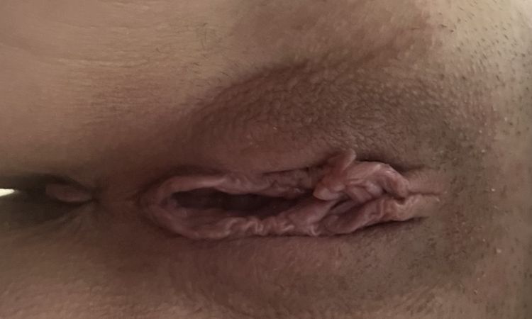 Schamlippen labien Korrektur  Asymmetrie nicht schön geworden - 67305