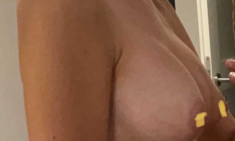 Habe ich eine Waterfall Deformity?? - 68588
