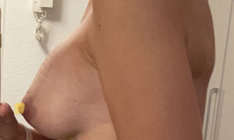 Habe ich eine Waterfall Deformity?? - 68589