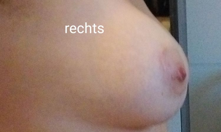 Meinung zum Ergebnis nach Brust-OP - 69234