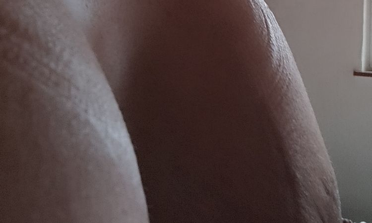 Bruststraffung mit Vergrößerung - 73044