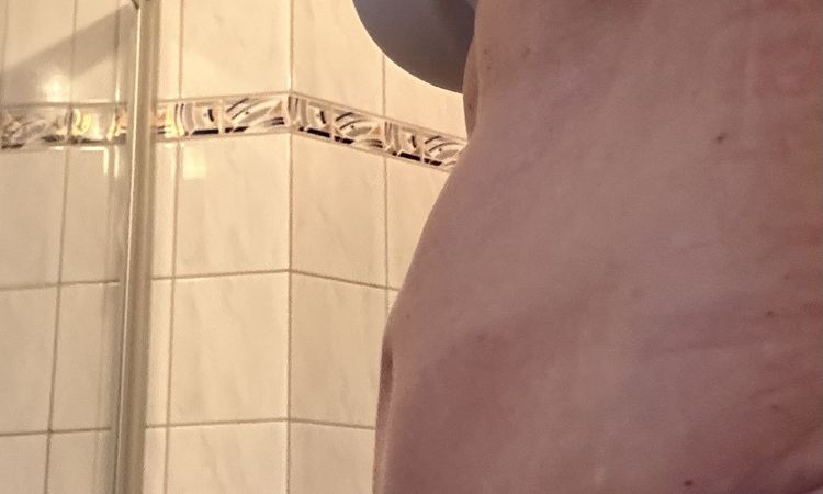 Schwellung nach 10 Wochen so normal? - 75289