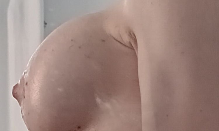 Ist es eine Waterfall Deformity? - 77561