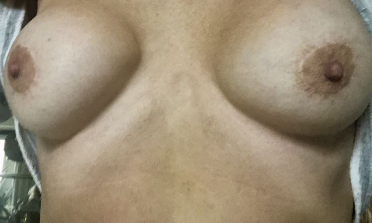 Deformation Brustimplantat durch Mammographie bei Kapselfibrose? - 79286