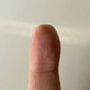 Rekonstruktion Teil der Fingerkuppe