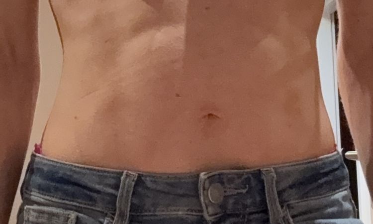 Asymmetrie und Druckgefühl nach Brustvergrößerung - 79479